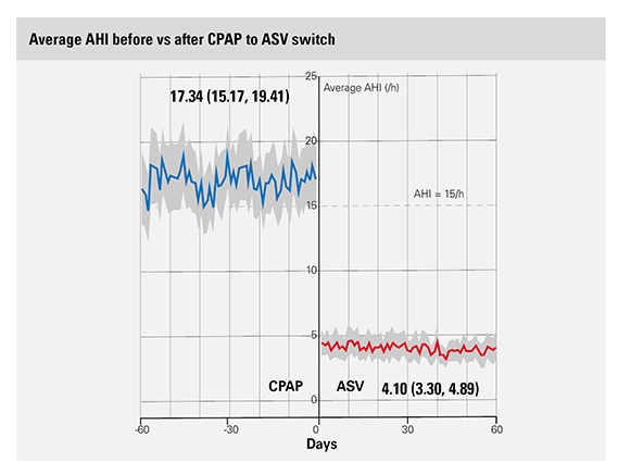 big-data-ASV-bytte-AHI-ResMed