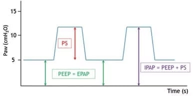 graf som viser forskjellen mellom PS, PEEP og IPAP