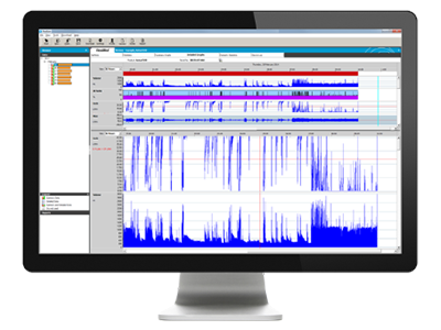 ResScan programvare for behandling av pasientbehandling ResMed